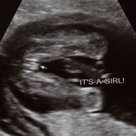 femboy scan|GENDER.